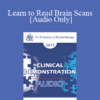 [Audio] EP17 Clinical Demonstration 10 - Learn to Read Brain Scans: 50 cases in 60 Minutes - Daniel Amen