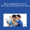 Audio and Video Dr. Jennifer J Pedley MR Radiograph Review of the Lumbar Spine » Courses[GB]