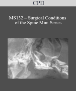 CPD - MS132 – Surgical Conditions of the Spine Mini Series