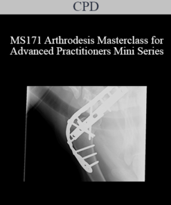 CPD - MS171 Arthrodesis Masterclass for Advanced Practitioners Mini Series