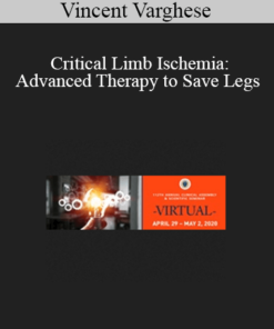 Vincent Varghese - Critical Limb Ischemia: Advanced Therapy to Save Legs